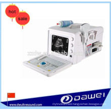 portable ultrasonic diagnostic scanner & medical ultrasound equipment